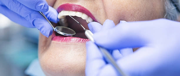 Best Emergency Treatment for Toothache in Palmyra, NJ
